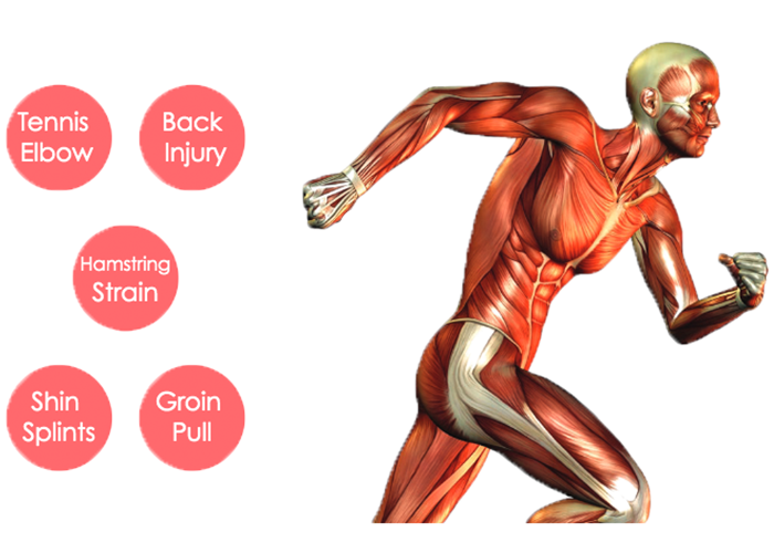 common-injuries-sportsperson