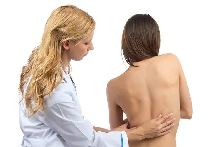 scoliosis-01