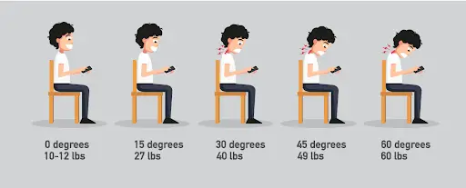 Text Neck (Forward Head Posture)