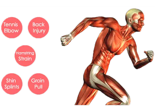 Alleviating Common Sports Injuries with Chiropractic Care